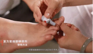 治灰指甲用亮甲效果怎么样?要对自己有信心